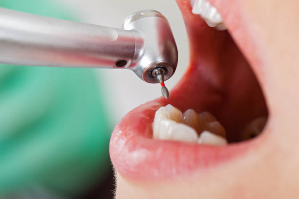 Best Urgent Care for Lost Fillings or Crowns in Laflin, PA
